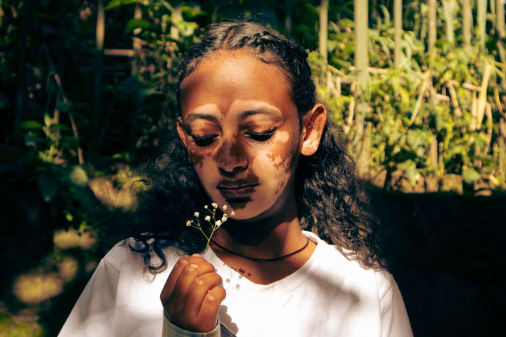 Birthmarks and Past Life Regression | Soul Marks Explained